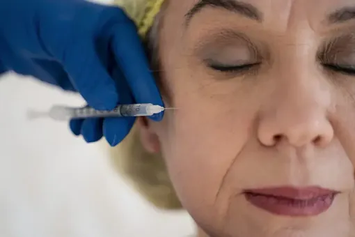 Estella-mesoterapia-facial-en-Sevilla-Este-Sevilla